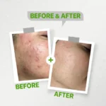see lit - daky - firstvoc - medinza -serum - hair - body - care - kolanoge - skin care - سي ليت - ميدينزا - العنايه بالشعر - العنايه بالبشرة - داكى - فيرست فوك - كولانوج - سي - ليت