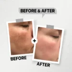 see lit - daky - firstvoc - medinza -serum - hair - body - care - kolanoge - skin care - سي ليت - ميدينزا - العنايه بالشعر - العنايه بالبشرة - داكى - فيرست فوك - كولانوج - سي - ليت