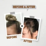 FirstVoc Anti-HairLoss Ampoules - Image 3