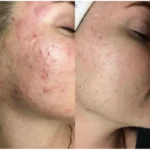 see lit - daky - firstvoc - medinza -serum - hair - body - care - kolanoge - skin care - سي ليت - ميدينزا - العنايه بالشعر - العنايه بالبشرة - داكى - فيرست فوك - كولانوج - سي - ليت