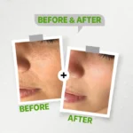 Facial Cleanser See lit - Image 3