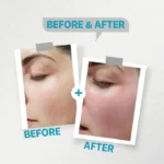 see lit - daky - firstvoc - medinza -serum - hair - body - care - kolanoge - skin care - سي ليت - ميدينزا - العنايه بالشعر - العنايه بالبشرة - داكى - فيرست فوك - كولانوج - سي - ليت