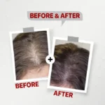 see lit - daky - firstvoc - medinza -serum - hair - body - care - kolanoge - skin care - سي ليت - ميدينزا - العنايه بالشعر - العنايه بالبشرة - داكى - فيرست فوك - كولانوج - سي - ليت