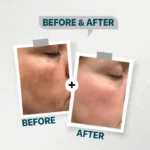 see lit - daky - firstvoc - medinza -serum - hair - body - care - kolanoge - skin care - سي ليت - ميدينزا - العنايه بالشعر - العنايه بالبشرة - داكى - فيرست فوك - كولانوج - سي - ليت
