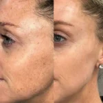 see lit - daky - firstvoc - medinza -serum - hair - body - care - kolanoge - skin care - سي ليت - ميدينزا - العنايه بالشعر - العنايه بالبشرة - داكى - فيرست فوك - كولانوج - سي - ليت