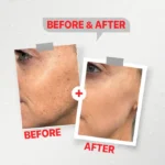 see lit - daky - firstvoc - medinza -serum - hair - body - care - kolanoge - skin care - سي ليت - ميدينزا - العنايه بالشعر - العنايه بالبشرة - داكى - فيرست فوك - كولانوج - سي - ليت
