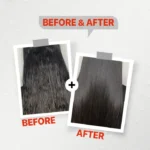 ⁦FirstVoc Anti Dandruff shampoo⁩ - الصورة ⁦3⁩