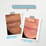 Kolanog antiaging cleanser for dry skin - كولانوج غسول وجه مضاد التجاعيد للبشرة الجافة