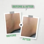 see lit - daky - firstvoc - medinza -serum - hair - body - care - kolanoge - skin care - سي ليت - ميدينزا - العنايه بالشعر - العنايه بالبشرة - داكى - فيرست فوك - كولانوج - سي - ليت