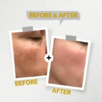 SeeLit Professional - Image 3