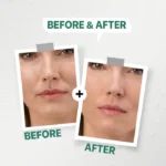 ⁦داكي رتينول هيالورونيك اسيد سيروم⁩ - الصورة ⁦4⁩