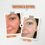 see lit - daky - firstvoc - medinza -serum - hair - body - care - kolanoge - skin care - سي ليت - ميدينزا - العنايه بالشعر - العنايه بالبشرة - داكى - فيرست فوك - كولانوج - سي - ليت
