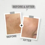 Hyaluronic Facial cleanser - Image 3