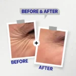 Hyaluronic Vit(B) ,Plumping serum - Image 3