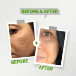 كولانوج غسول رغوي للتقشير الدقيق - Kolanog micro-peeling foam cleanser